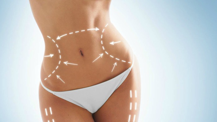 coolsculpting